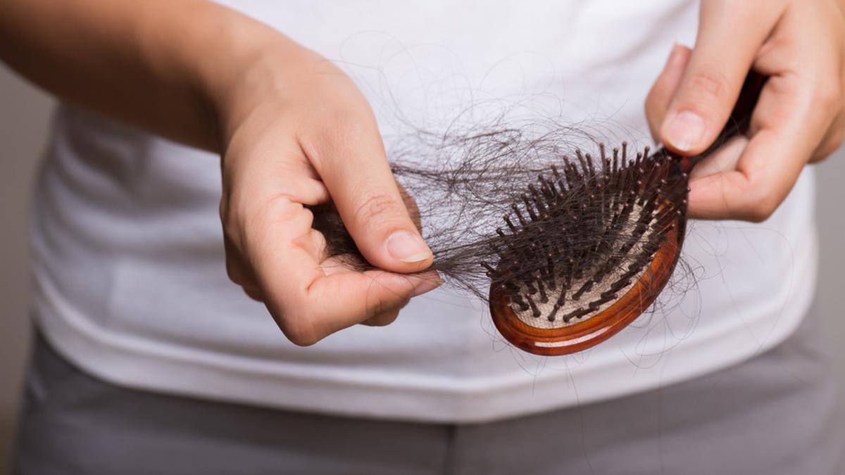 Cara Merawat Rambut Rontok