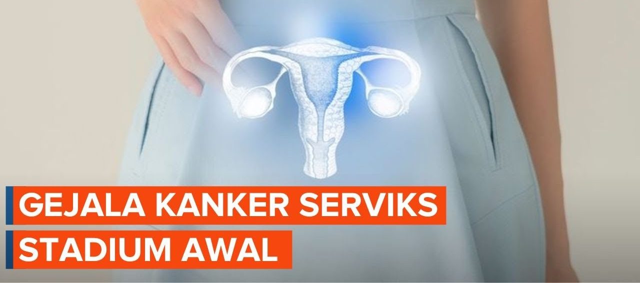 Kanker Serviks Stadium Awal: Apa Yang Harus Diketahui Wanita?