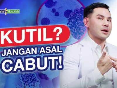 Tips Menghilangkan Kutil