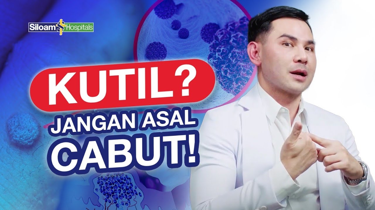 Tips Menghilangkan Kutil Mulai Dari Alami Hingga Medis