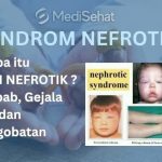 Mengenal Sindrom Nefrotik: Penyakit Ginjal Pada Anak-Anak
