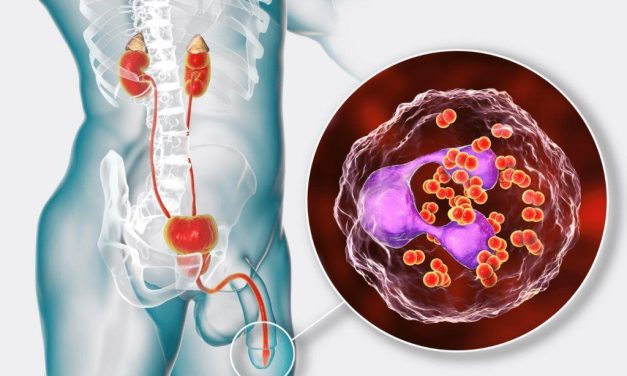 Penyakit Gonore Kenali Gejala, Penyebab Dan Pengobatannya