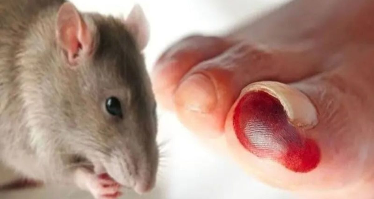 Penyakit Leptospirosis Menular Dari Hewan Ke Manusia