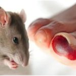 Penyakit Leptospirosis Menular Dari Hewan Ke Manusia