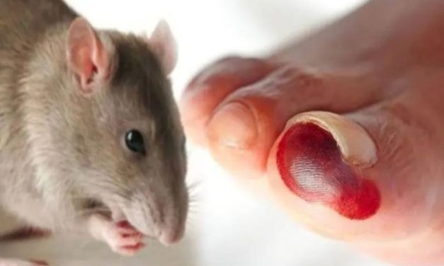 Penyakit Leptospirosis Menular Dari Hewan Ke Manusia