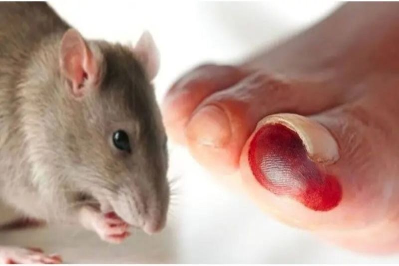 Penyakit Leptospirosis